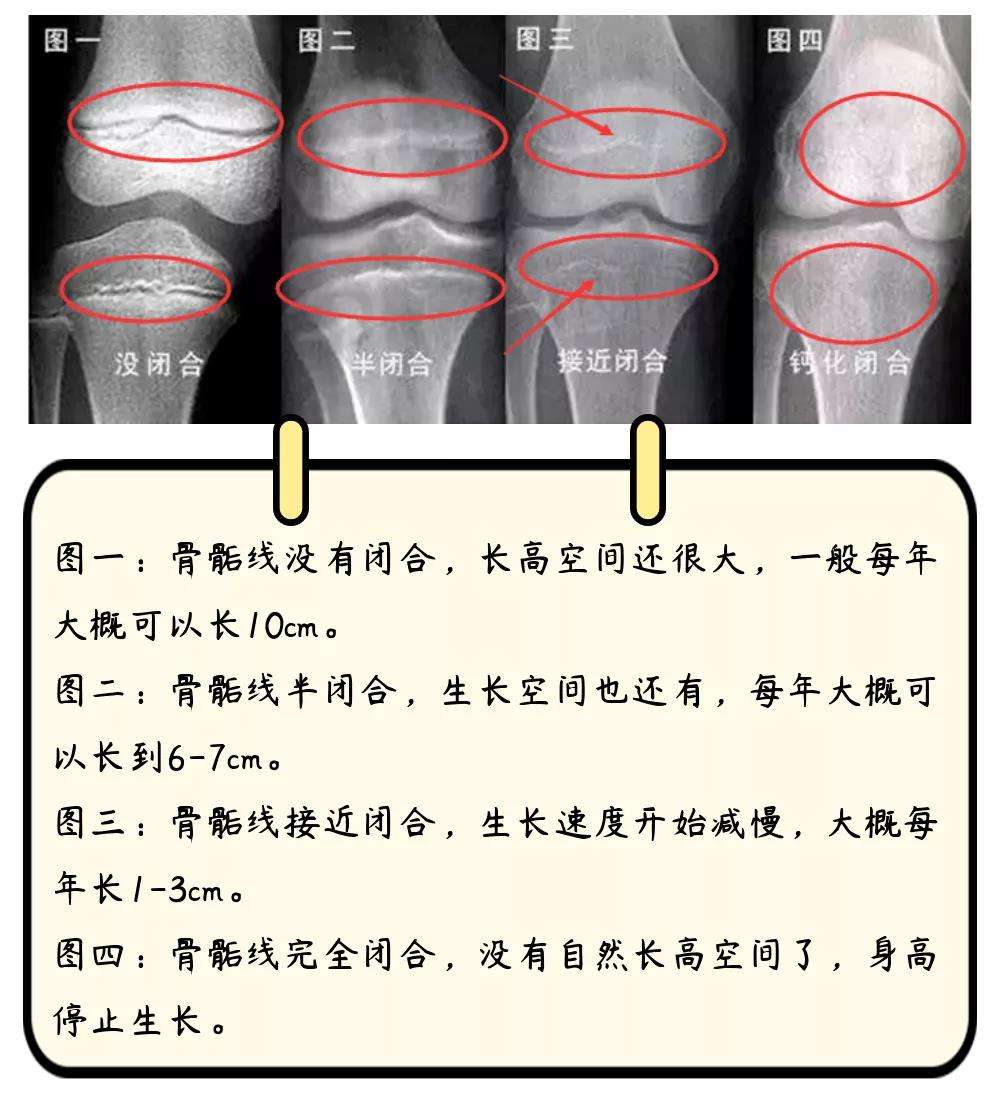 长高药可以长高吗_长高药可以配面包吃吗_什么药可以长高