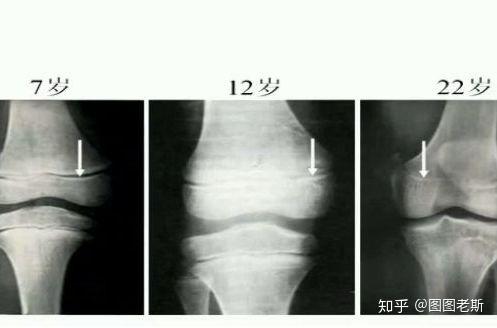 长高药可以配面包吃吗_什么药可以长高_长高药可以长高吗