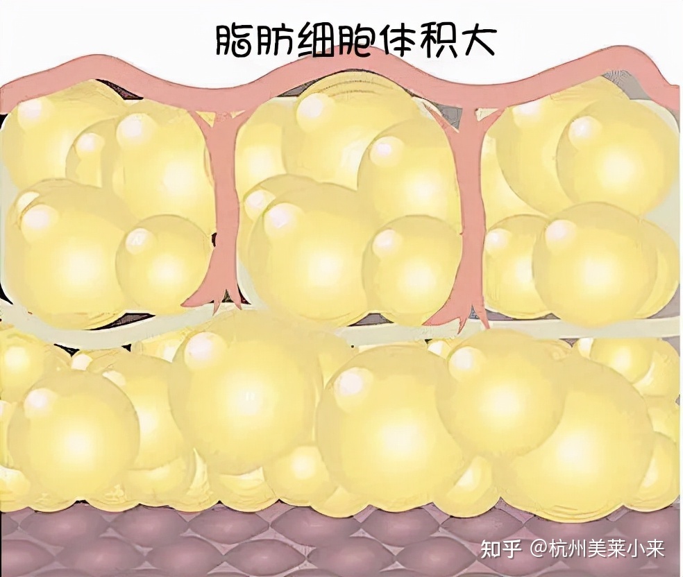 仪器减肥美容加盟_仪器减肥美容图片_减肥美容仪器