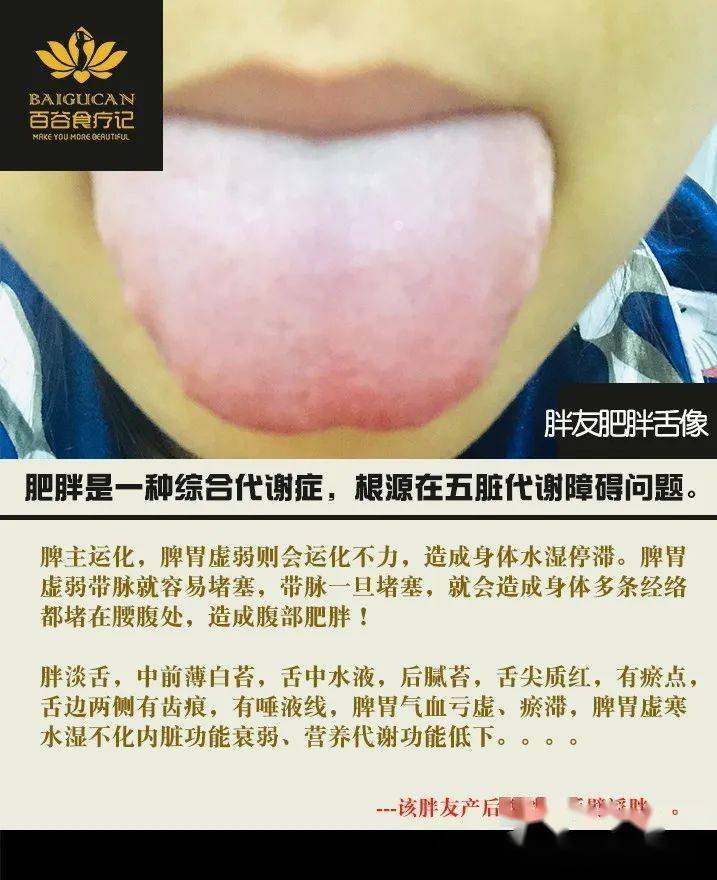 齿痕舌调理_治舌头齿痕的中药秘方_舌齿痕怎么调理