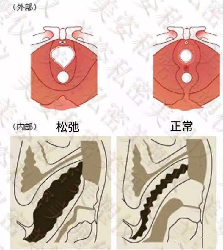 哪种缩阴产品效果好_哪种缩阴产品效果好_哪种缩阴产品效果好