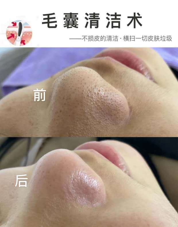 面部调理霜使用方法_面部调理霜的作用_面部调理清洁霜