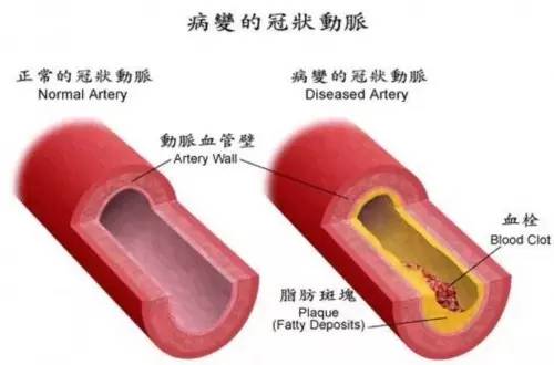 血管脑健康心得感悟_心脑血管健康_血管脑健康心得怎么写