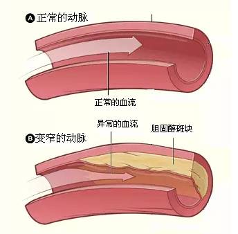 血管脑健康心得怎么写_心脑血管健康_血管脑健康心得感悟