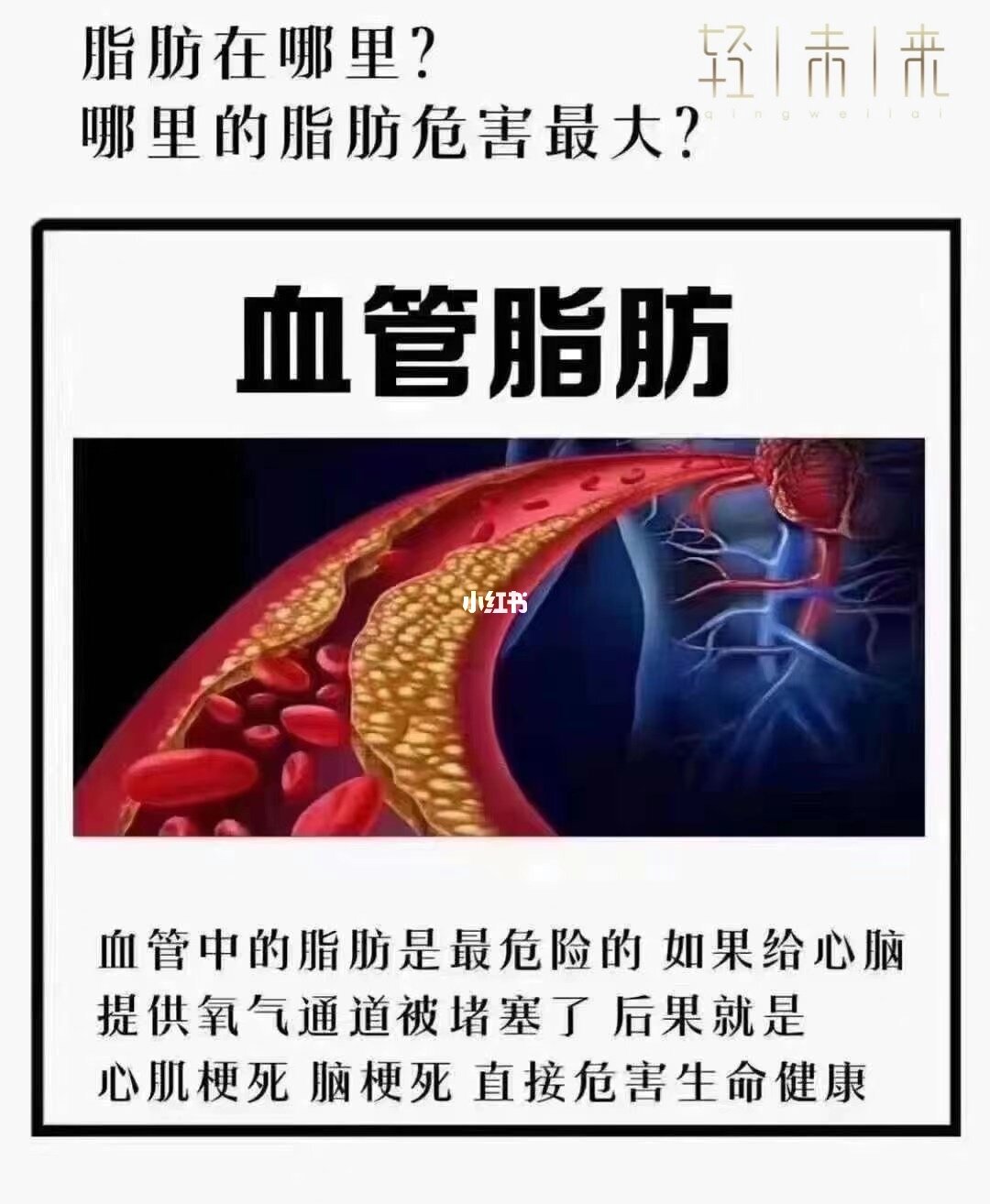 血管脑健康心得怎么写_心脑血管健康_血管脑健康心得体会