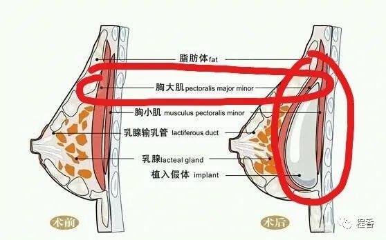 怎么样减肥不瘦胸_怎么样减肥不瘦胸_怎么样减肥不瘦胸