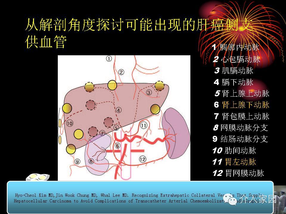 肝癌一般用什么抗癌药物_治疗肝癌用什么药_肝癌用五芝液